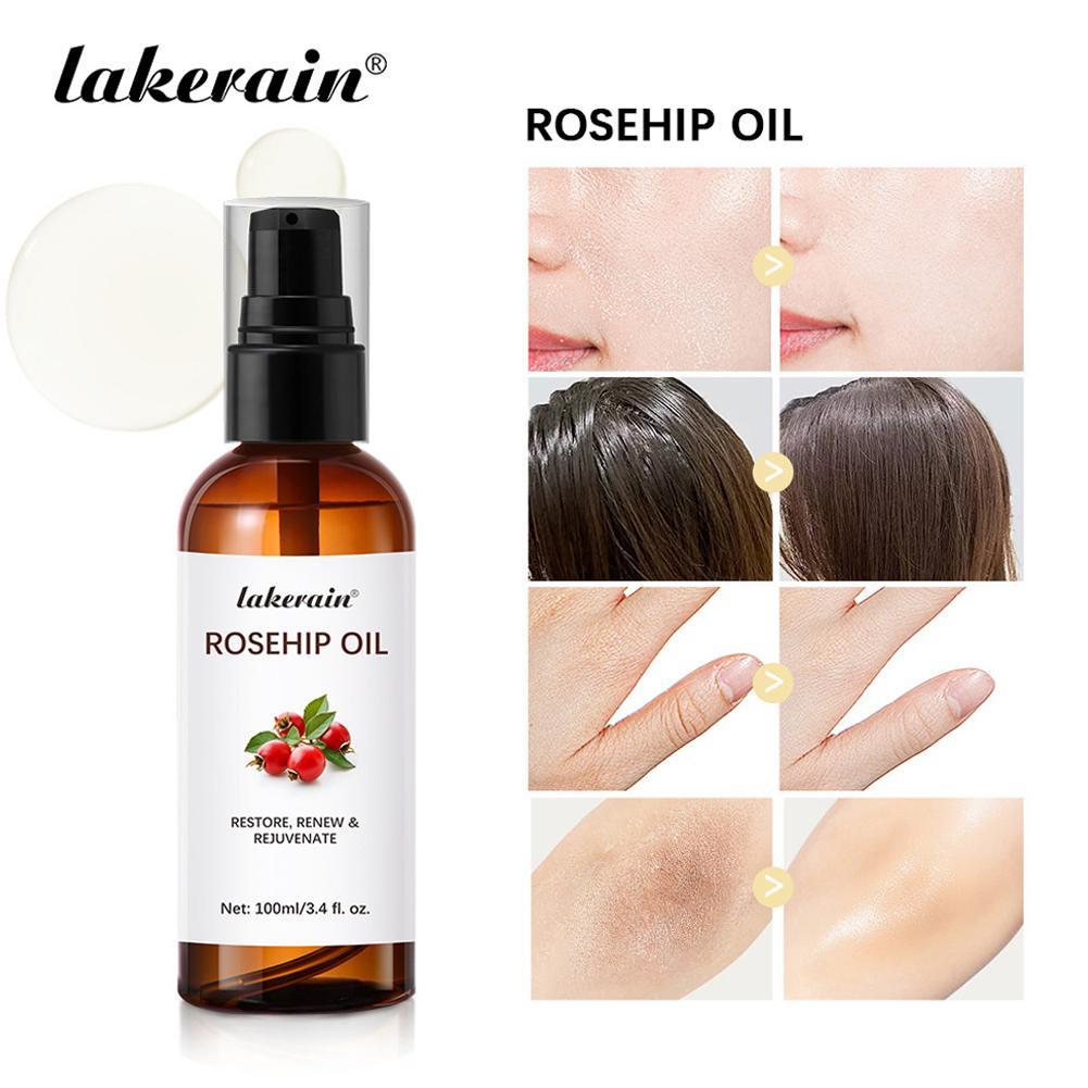 Rosehip Oil For Face & Skin Or - Cold Pressed Rose Hip 评论和价格