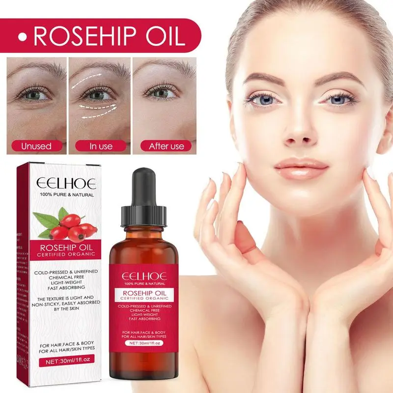 30ml Organic Rosehip Seed Oil  - Cold Pressed Rose Hip 评论和价格